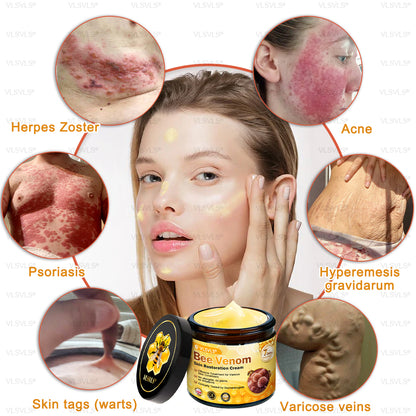 ✨🇬🇧✨Made and Shipped from UK ✨ VLSVLS® Bee Venom Skin Restoration Cream 🔥 LAST DAY 80% OFF