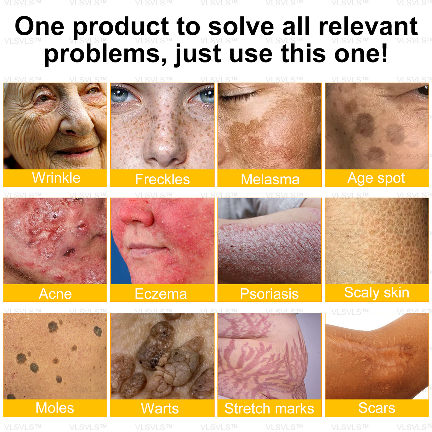 ✨🇬🇧✨Made and Shipped from UK ✨ VLSVLS® Bee Venom Skin Restoration Cream 🔥 LAST DAY 80% OFF