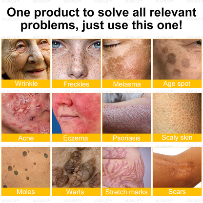 ✨🇬🇧✨Made and Shipped from UK ✨ VLSVLS® Bee Venom Skin Restoration Cream 🔥 LAST DAY 80% OFF