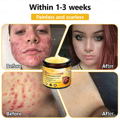 ✨🇬🇧✨Made and Shipped from UK ✨ VLSVLS® Bee Venom Skin Restoration Cream 🔥 LAST DAY 80% OFF