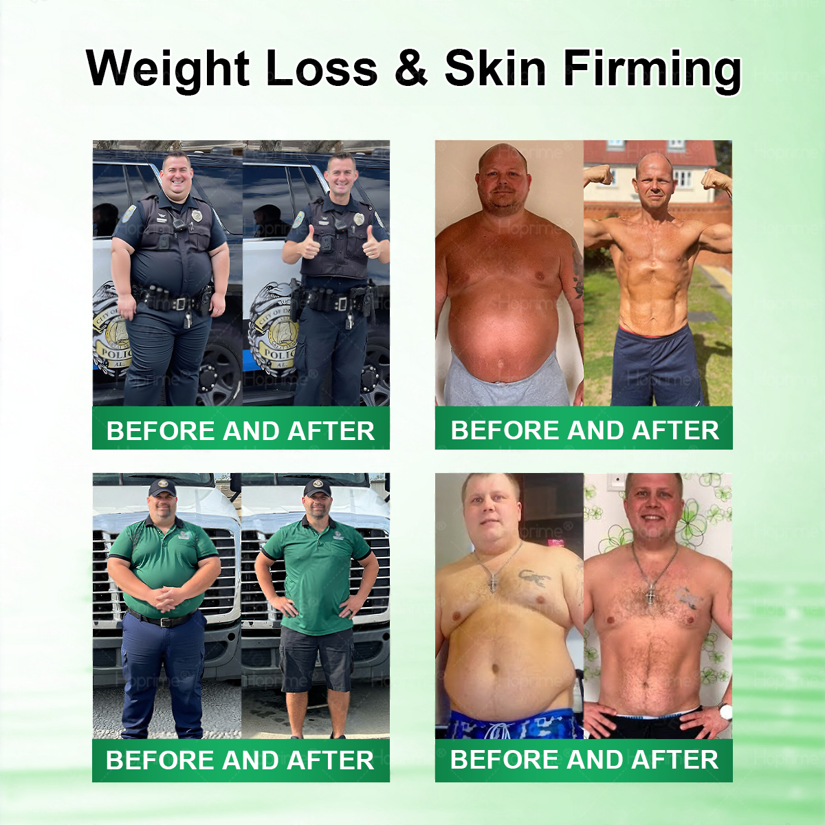 𝑯𝒐𝒑𝒓𝒊𝒎𝒆® 𝑴𝒐𝒓𝒊𝒏𝒈𝗮 · 𝗕𝗲𝗿𝗯𝗲𝗿𝙞𝙣𝙚 × 𝙉𝘼𝐃+ 𝟏𝟎-𝐢𝐧-𝟏 𝗔𝗱𝘃𝗮𝗻𝗰𝙚𝙙 𝙉𝙖𝙣𝙤 𝙈𝙞𝙘𝙧𝙤𝙣𝙚𝙚𝐝𝐥𝐞 𝐏𝐚𝐭𝙘𝙝🇬🇧(𝐉𝐮𝐬𝐭 𝐨𝐧𝐜𝐞 𝐚 𝐝𝐚𝐲, 𝐯𝐢𝐬𝐢𝐛𝐥𝐞 𝐜𝐡𝐚𝐧𝐠𝐞𝐬 𝐢𝐧 𝟕 𝐝𝐚𝐲𝐬） ✅ 𝐅𝐨𝐫 𝐨𝐛𝐞𝐬𝐢𝐭𝐲, 🅛🅞🅞🅢🅔 🅢🅚🅘🅝, 𝐝𝐢𝐚𝐛𝐞𝐭𝐞𝐬, 𝐬𝐥𝐞𝐞𝐩 𝐚𝐩𝐧𝐞𝐚, 𝐣𝐨𝐢𝐧𝐭 𝐢𝐬𝐬𝐮𝐞𝐬, 𝐚𝐧𝐝 𝐦𝐨𝐫𝐞