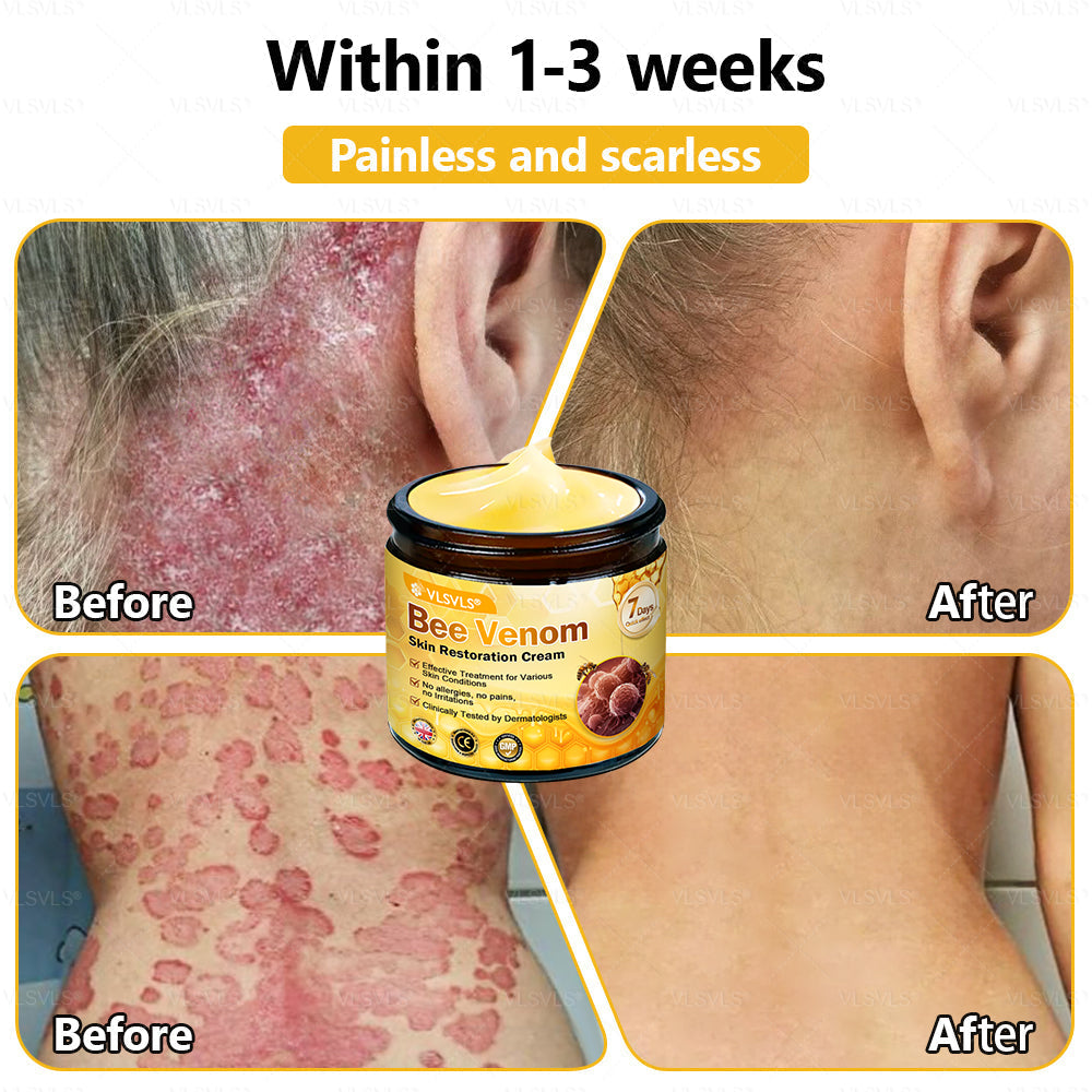 ✨🇬🇧✨Made and Shipped from UK ✨ VLSVLS® Bee Venom Skin Restoration Cream 🔥 LAST DAY 80% OFF