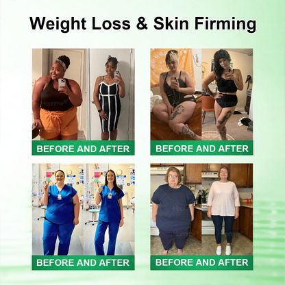 𝑯𝒐𝒑𝒓𝒊𝒎𝒆® 𝑴𝒐𝒓𝒊𝒏𝒈𝗮 · 𝗕𝗲𝗿𝗯𝗲𝗿𝙞𝙣𝙚 × 𝙉𝘼𝐃+ 𝟏𝟎-𝐢𝐧-𝟏 𝗔𝗱𝘃𝗮𝗻𝗰𝙚𝙙 𝙉𝙖𝙣𝙤 𝙈𝙞𝙘𝙧𝙤𝙣𝙚𝙚𝐝𝐥𝐞 𝐏𝐚𝐭𝙘𝙝🇬🇧(𝐉𝐮𝐬𝐭 𝐨𝐧𝐜𝐞 𝐚 𝐝𝐚𝐲, 𝐯𝐢𝐬𝐢𝐛𝐥𝐞 𝐜𝐡𝐚𝐧𝐠𝐞𝐬 𝐢𝐧 𝟕 𝐝𝐚𝐲𝐬） ✅ 𝐅𝐨𝐫 𝐨𝐛𝐞𝐬𝐢𝐭𝐲, 🅛🅞🅞🅢🅔 🅢🅚🅘🅝, 𝐝𝐢𝐚𝐛𝐞𝐭𝐞𝐬, 𝐬𝐥𝐞𝐞𝐩 𝐚𝐩𝐧𝐞𝐚, 𝐣𝐨𝐢𝐧𝐭 𝐢𝐬𝐬𝐮𝐞𝐬, 𝐚𝐧𝐝 𝐦𝐨𝐫𝐞