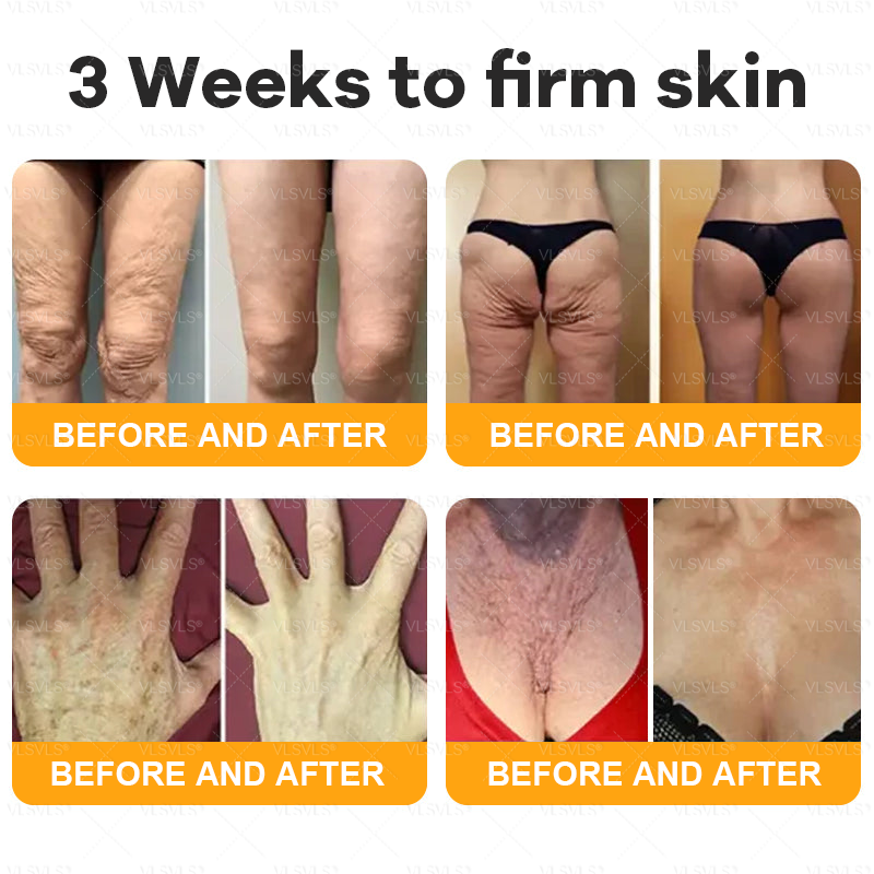 ✨🇬🇧✨Made and Shipped from UK ✨ VLSVLS® Bee Venom Skin Restoration Cream 🔥 LAST DAY 80% OFF