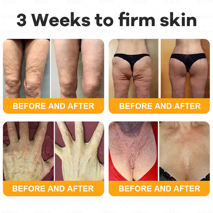 ✨🇬🇧✨Made and Shipped from UK ✨ VLSVLS® Bee Venom Skin Restoration Cream 🔥 LAST DAY 80% OFF