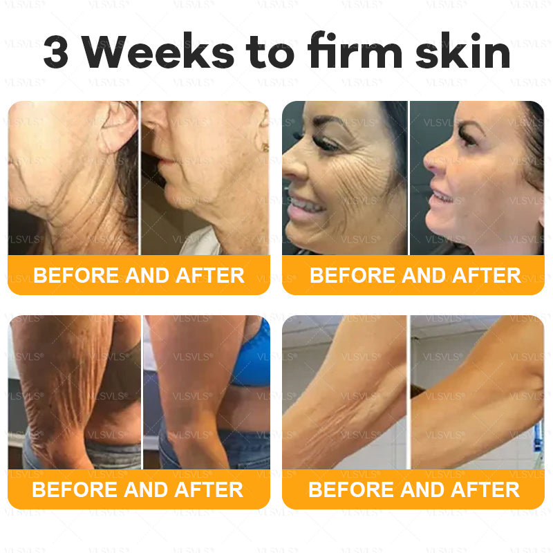 ✨🇬🇧✨Made and Shipped from UK ✨ VLSVLS® Bee Venom Skin Restoration Cream 🔥 LAST DAY 80% OFF