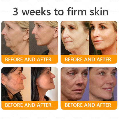 🇬🇧✨Made and Shipped from UK ✨ PUROSA® Bee Venom Wrinkle-Firming Multi-purpose Cream 🔥 LAST DAY 80% OFF