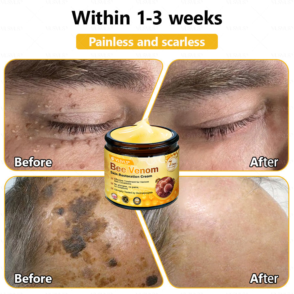 ✨🇬🇧✨Made and Shipped from UK ✨ VLSVLS® Bee Venom Skin Restoration Cream 🔥 LAST DAY 80% OFF