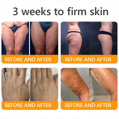 🇬🇧✨Made and Shipped from UK ✨ PUROSA® Bee Venom Wrinkle-Firming Multi-purpose Cream 🔥 LAST DAY 80% OFF