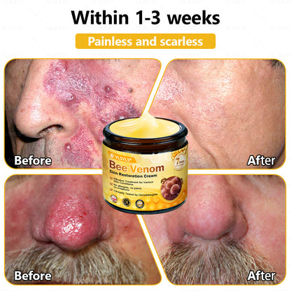 ✨🇬🇧✨Made and Shipped from UK ✨ VLSVLS® Bee Venom Skin Restoration Cream 🔥 LAST DAY 80% OFF