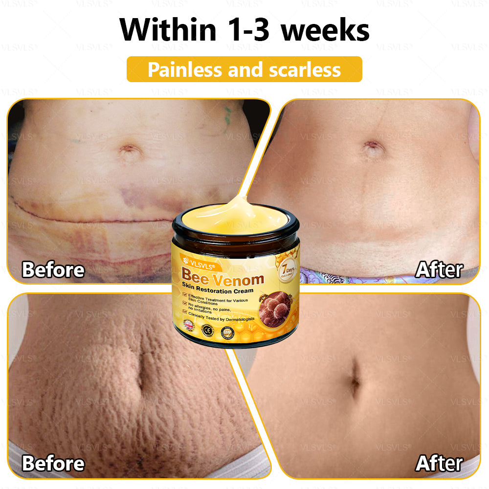 ✨🇬🇧✨Made and Shipped from UK ✨ VLSVLS® Bee Venom Skin Restoration Cream 🔥 LAST DAY 80% OFF