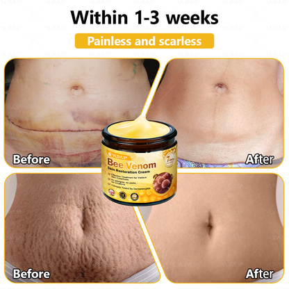 ✨🇬🇧✨Made and Shipped from UK ✨ VLSVLS® Bee Venom Skin Restoration Cream 🔥 LAST DAY 80% OFF